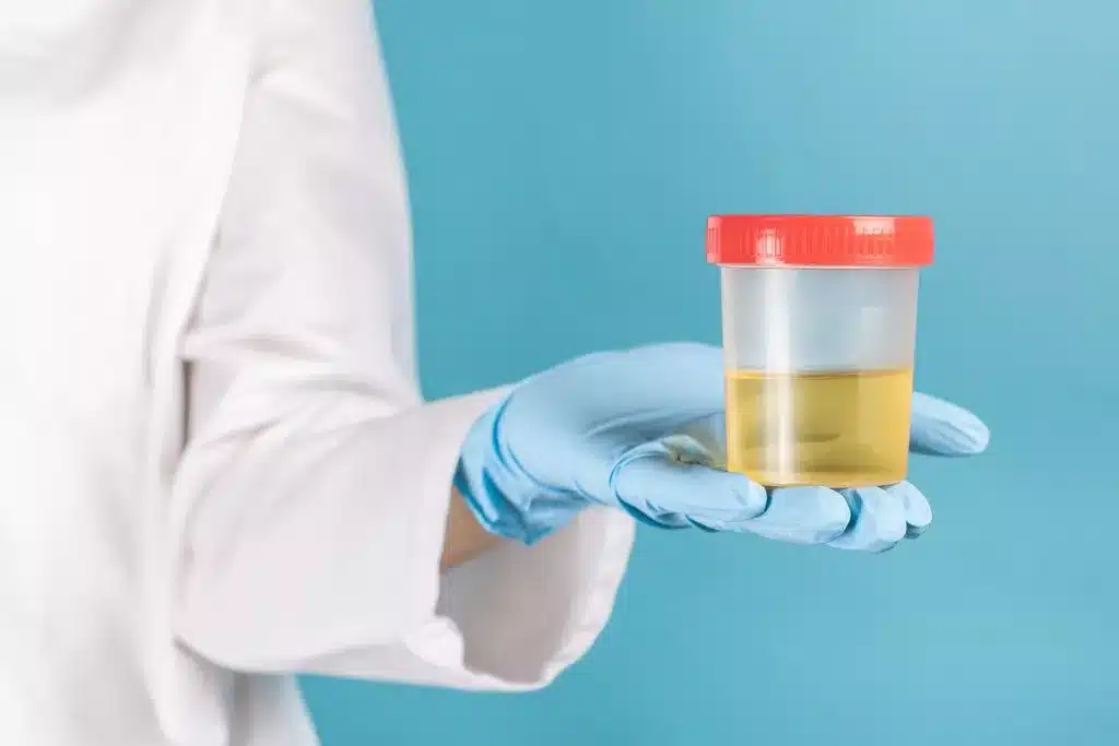 a person has a urine collection cup in his hand