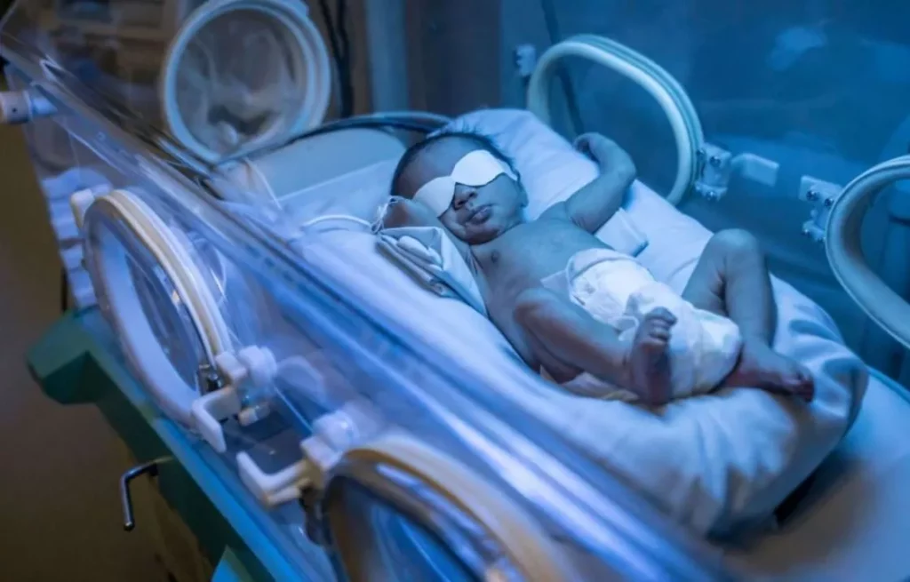 jaundice in newborn babies