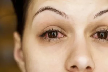 pink eye causes symptoms and treatment