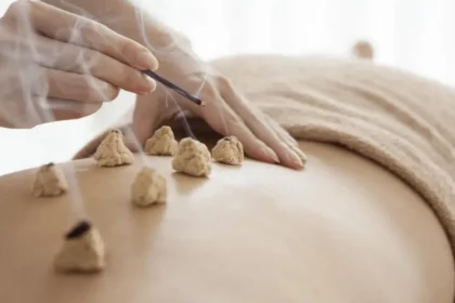 Moxibustion a ancient therapy on back