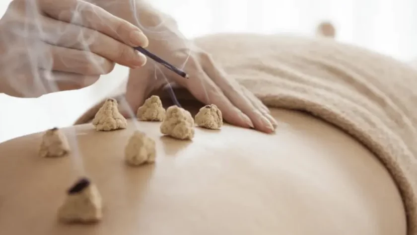 Moxibustion a ancient therapy on back