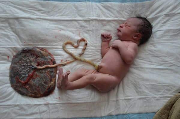 A baby connected with placenta through umbilical cord